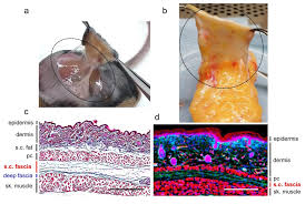 Furnishing Wound Repair by the Subcutaneous Fascia