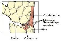Image result for icd 10 code for tear of triangular fibrocartilage complex
