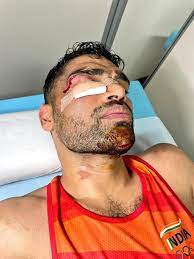 Satish kumar was the second indian boxer at the tokyo olympics to take the ring with an injury. Scxwpmxqc Bwxm