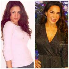 Elle passe toute son enfance entre toulon et marseille. Milla Jasmine Les Marseillais Vs Le Reste Du Monde Avant Apres La Chirurgie Esthetique Purebreak