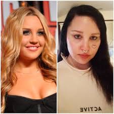 Amanda Bynes then vs. now