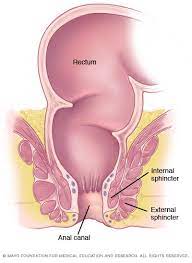 Healing Anal Fissures Using Anal Sphincter Massage