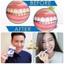 Dazzling white sangat mudah penggunaanya, cukup dioles pada gigi dan tunggu 30 menit saja gigi pun seketika menjadi putih dan lebih percaya diri. Terlaris Ready Pemutih Gigi Dazzling White Whitening Tooth Gel Pen Original Usa No Box Shopee Indonesia
