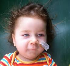 Et CITRON'enfant était atteint