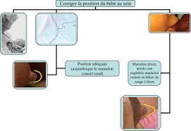 5 types d'aliments à privilégier pendant votre allaitement. Allaitement Maternel Difficultes Et Complications Sciencedirect