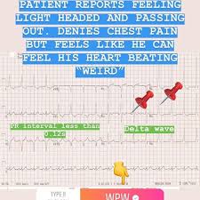 「http://macska.tv/node/ stress」的圖片搜尋結果