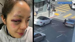 Woman attacked, robbed and dragged through street while leaving church in  San Francisco's Nob Hill - ABC7 Los Angeles