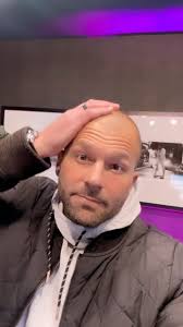 👨🏼‍🦲🧑🏾‍🦲👨🏿‍🦲🧑🏻‍🦲Who else started going bald in their 30s??, In  the words of the great theologian, O.T. Genesis- “You need to CUT-it!”,  Change is good… 🤔 What do you think?, #bald #balding ...