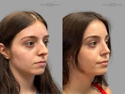Providence Facial Plastic and Cosmetic Surgery