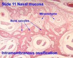 Bone cross section + long bone. Bone