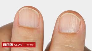 Fragiles Amarillentas O Con Manchas Blancas Cuales Son Las Anomalias Y Problemas Mas Frecuentes De Las Unas Bbc News Mundo