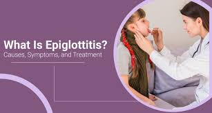 Image result for Epiglottitis