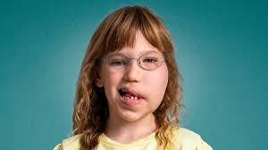 Læge om Mille fra De sjældne danskere: Jeg kommer kun til at se det ene  tilfælde i hele min karriere