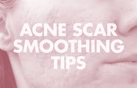 smooth indented acne s on your skin