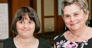 Canadians with Down syndrome living longer, but still dying prematurely,  study says