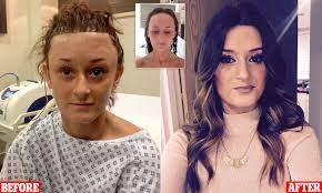 This is easiest to do, pick a foundation that is darker than your natural shade. Kent Woman Bullied For Large Forehead Got 6 500 Surgery Daily Mail Online