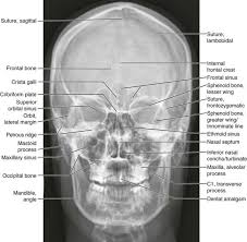 Skull Caldwell Medical Radiography Radiology Imaging Radiology Student