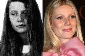 / نانسي عجرم وتامر حسني يشعلان الأجواء في أ. Ù†Ø¬Ù…Ø§Øª Ù‡ÙˆÙ„ÙŠÙˆÙˆØ¯ ÙŠØ¹ØªØ±ÙÙ† Ø¨Ø¥Ø¬Ø±Ø§Ø¦Ù‡Ù† Ø¹Ù…Ù„ÙŠØ§Øª ØªØ¬Ù…ÙŠÙ„ ÙƒÙŠÙ Ø£ØµØ¨Ø­ Ø´ÙƒÙ„Ù‡Ù† Ù…ÙˆÙ‚Ø¹ Ø¹Ø±Ø¨ÙŠ Ø£Ù…Ø±ÙŠÙƒÙŠ