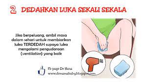 Idealnya, sariawan memang butuh waktu untuk sembuh dengan sendirinya. Ibu Baru 7 Hari Bersalin Jahitan Luka Terbuka Benang Tertetas Doktor Bagi Tip Penjagaan Pa Ma