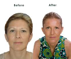 Facial Rejuvenation Acupressure Look Younger Naturally