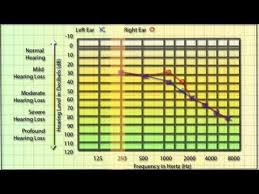 2 ﻿ for example, at 125 hz you may be able to only hear the sound at 50 decibels. Pin On Speech And Language