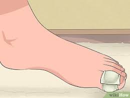 Intervention is especially required when a possibility of cancer exists. 3 Ways To Treat Pyogenic Granuloma Wikihow