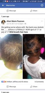 Promotes thick, long hair growth. Before And After