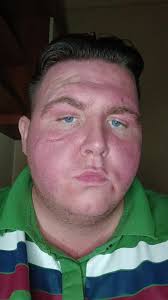 Sunbed Results Showcase: Radiant Glow After 12-Min Session!