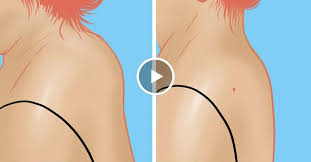 как избавиться от волос на теле раз и навсегда Vdovij Gorbik Vam Ne Nuzhen Srochno Nachinajte Delat Eti Uprazhneniya Video Uprazhneniya Zdorove Trenirovki Zhivota