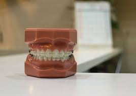 Take 12 to 18 inches of floss and gently go behind the brace wire. How Can I Tell If My Child Needs Braces Do It Easy With Scienceprog