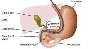 Maybe you would like to learn more about one of these? Koch S Etiology Apicolordotic View Confirms The Presence Of Practo Consult
