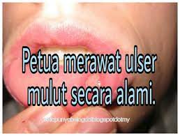 Aduh Sakitnya Ulser Mulut Ni Ada Petua Macam Mana Nak Merawatnya Tak About Me Blog Ada Blog