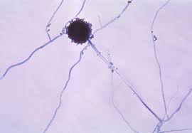 Aspergillus niger is among the most common fungi isolated from nuts (peanuts, pecans, pistachios, hazelnuts, walnuts, kola nuts, coconut and copra). Genom Von Aspergillus Niger Sequenziert
