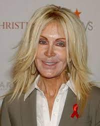 Joan Van Ark Not A Good Look Joan Celebrity Plastic Surgery Bad Plastic Surgeries Plastic Surgery