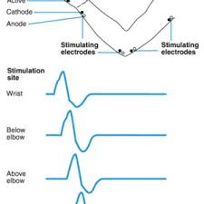 Check spelling or type a new query. 24 Forms Simplified Tai Chi Chuan Download Scientific Diagram