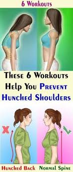 Pin On Arthritis