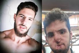 Fundraiser by Hassen Beydoun : George needs your help to survive.