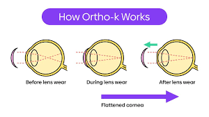 Image result for Lens