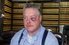 County rejects $10 million claim by defense lawyer injured in courthouse  fight