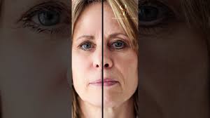 Dara Levy of Dermaflash unveils how she invented at-home dermaplaning!