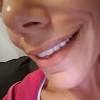 How to fix a gummy smile with lip fillers. Https Encrypted Tbn0 Gstatic Com Images Q Tbn And9gcrd2svk7tzzfvc Y1f6rsm4nummmmeylyi2lvn6iqylhtpq Ghd Usqp Cau