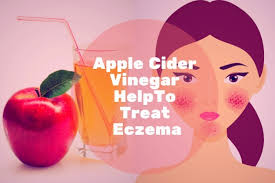 The coconut oil helps reduce inflammation while providing soothing. Apple Cider Vinegar For Eczema How To Use It Guide