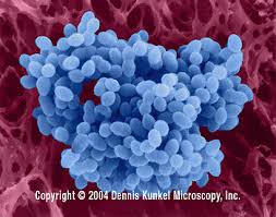 Image result for Group D Streptococcus