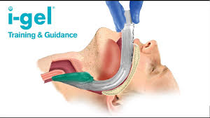 Intersurgical I Gel Supraglottic Airway