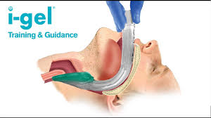 intersurgical i gel supraglottic airway