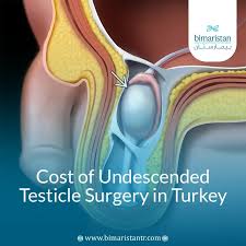 Image result for Undescended Testicle