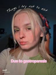 My Gastroparesis Journey: Overcoming Gaslighting and Misdiagnosis