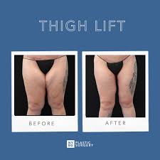 NYBG Plastic Surgery