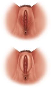 آیا رابطه جنسی زیاد باعث گشادی واژن می‌شود؟