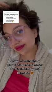 Qué Pasa Si Le Echo Agua De Romero A Mi Bebé De 6 Meses En El Cabello